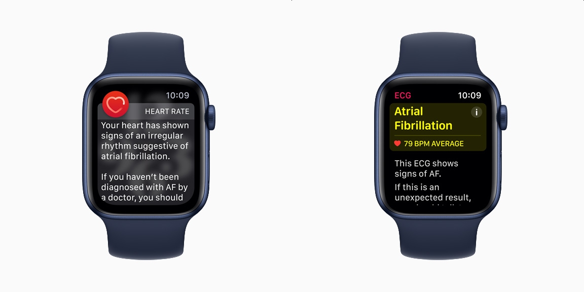 How To Set Up & Use AFib History On Apple Watch