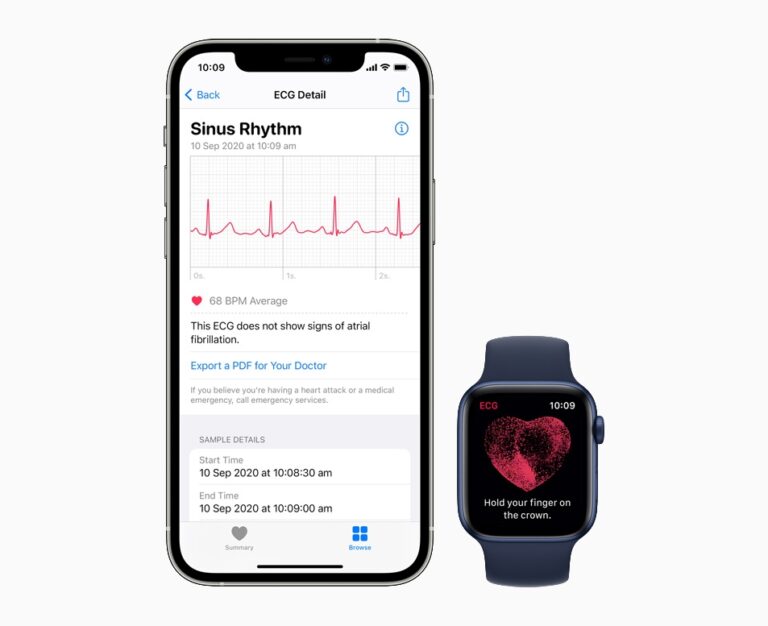 get ecg on apple watch
